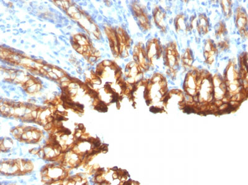 Cytokeratin 19 (KRT19) (Pancreatic Stem Cell Marker) Antibody - With BSA and Azide