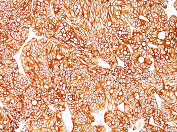 Cytokeratin 18 (KRT18) Antibody - With BSA and Azide