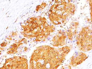 Arginase 1 (Hepatocellular Carcinoma Marker) Antibody - With BSA and Azide