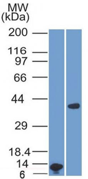 Arginase 1 (Hepatocellular Carcinoma Marker) Antibody - With BSA and Azide