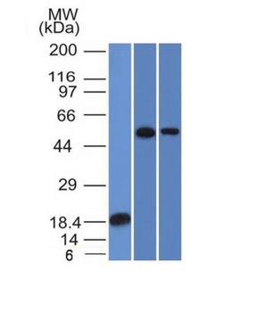 TOX3 / TNRC9 Antibody - With BSA and Azide