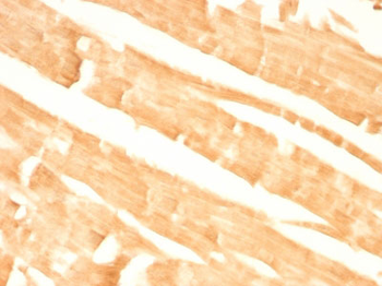 Glypican-3 (GPC3) (Hepatocellular Carcinoma Marker) Antibody - With BSA and Azide