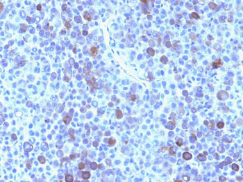Glypican-3 (GPC3) (Hepatocellular Carcinoma Marker) Antibody - With BSA and Azide