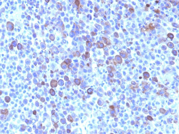 Glypican-3 (GPC3) (Hepatocellular Carcinoma Marker) Antibody - With BSA and Azide