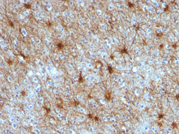 GFAP (Astrocyte & Neural Stem Cell Marker) Antibody - With BSA and Azide