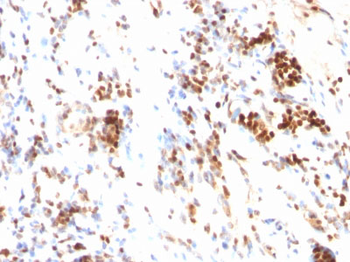 p27Kip1 (Mitotic Inhibitor/Suppressor Protein) Antibody - With BSA and Azide