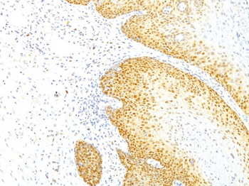 p27Kip1 (Mitotic Inhibitor/Suppressor Protein) Antibody - With BSA and Azide