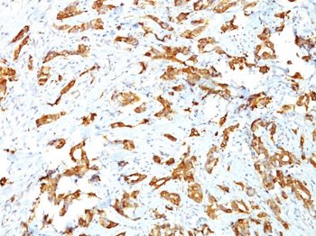 HSP27 (Heat Shock Protein 27) Antibody - With BSA and Azide