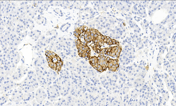 SSTR 2 Antibody