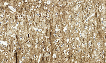 MAP2 Antibody