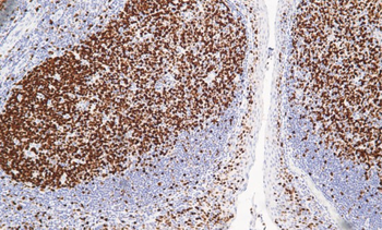 MKI67 Antibody