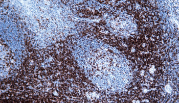 CD2 Antibody