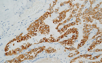 ALK Antibody