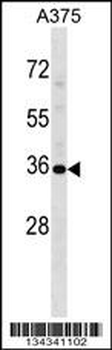 USP12 Antibody (Center)