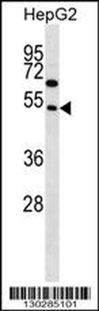 FAM83A Antibody (Center D283)