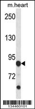 Mouse Cdkl5 Antibody (C-term)