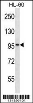 KANK2 Antibody (Center)