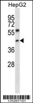 NFYC Antibody (N-term)