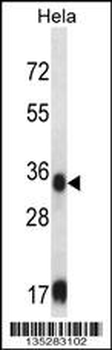 SORD Antibody (Center)