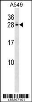 C4BPB Antibody (Center)