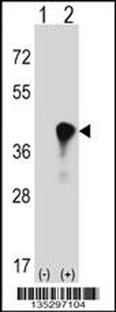 C4BPB Antibody (Center)