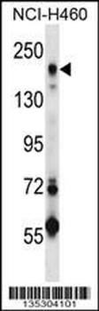 MRC2 Antibody (Center)