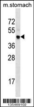 Mouse Cdk20 Antibody (Center)