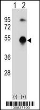 GATA3 Antibody (Center)