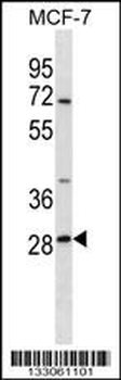 SRPRB Antibody (C-term)