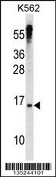 MXD3 Antibody (N-term)