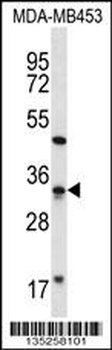 FTSJ1 Antibody (N-term)