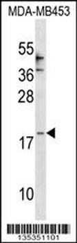 CCL25 Antibody (Center)