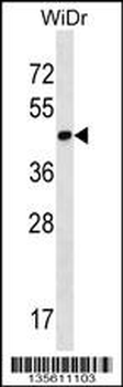 THAP11 Antibody (N-term)