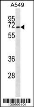 CSRNP3 Antibody (N-term)