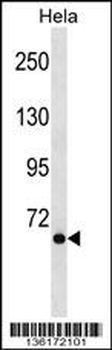 NCOA4 Antibody (C-term)