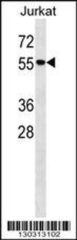 Mouse Mapk14 Antibody (N-term)