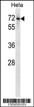 Mouse Bmpr1b Antibody (Center)