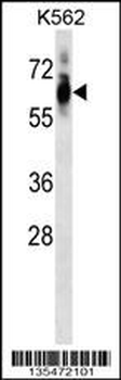Mouse Cdk8 Antibody (Center)