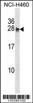 MOCS2 Antibody (N-term)