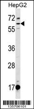 DEPDC1B Antibody (C-term)