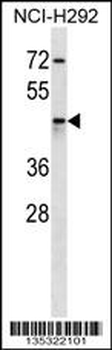 AKR1C4 Antibody (N-term)