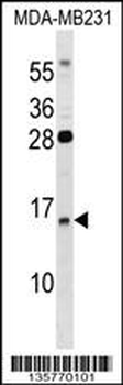 GUCA2B Antibody (C-term)
