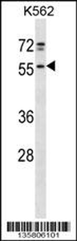 NFS1 Antibody (Center)
