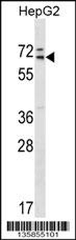 MED26 Antibody (Center)