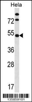 IP6K1 Antibody (N-term)