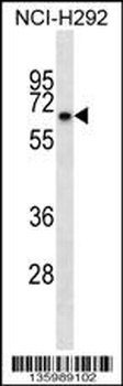 KBTBD10 Antibody (C-term)