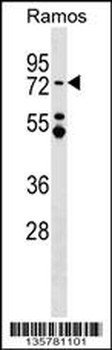 MTA3 Antibody (C-term)