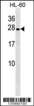 PGRMC2 Antibody (C-term)