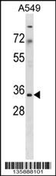 MRPS15 Antibody (Center)