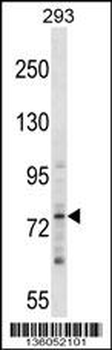 ZNF81 Antibody (N-term)